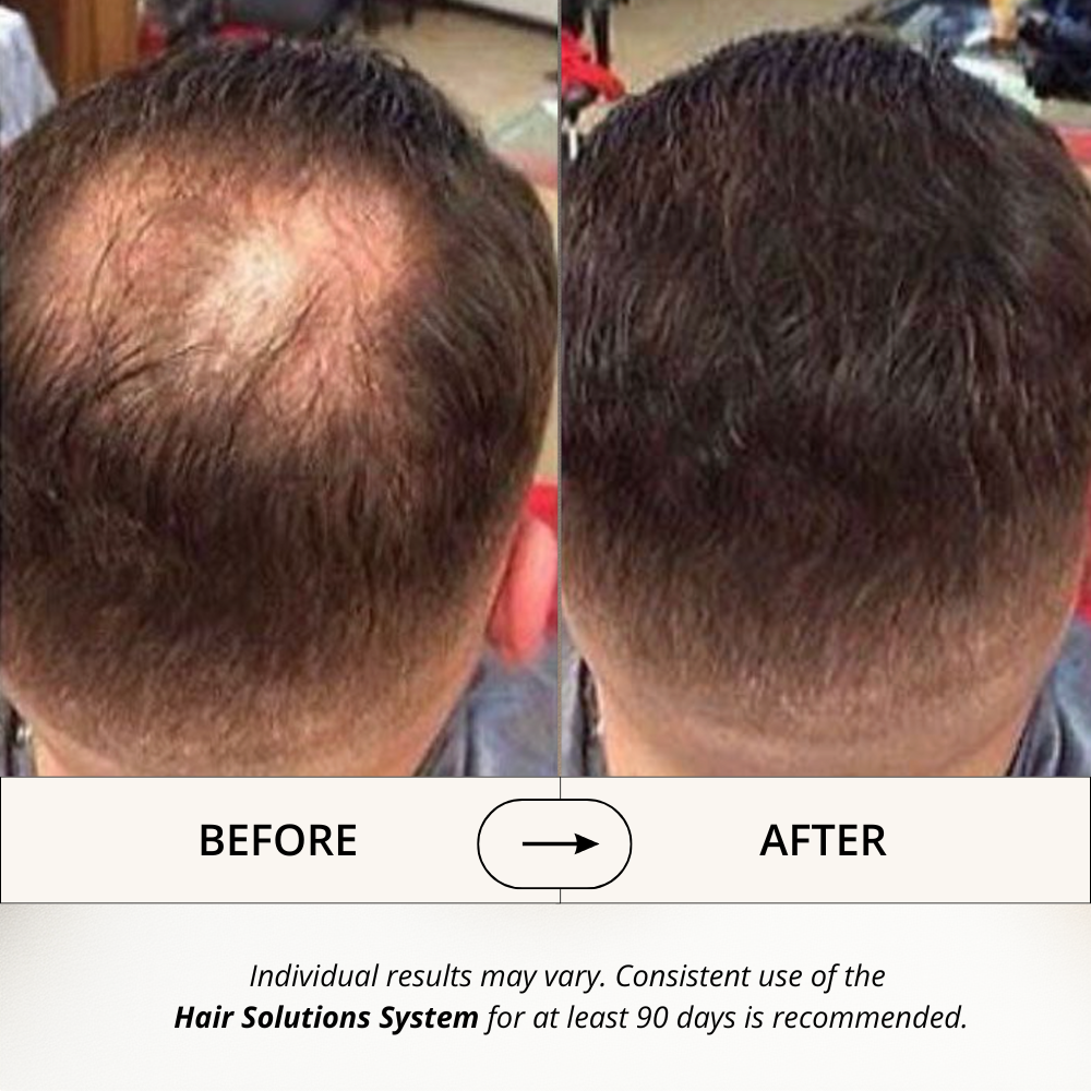 Hair Solutions | Energizing Hair Growth Conditioner
