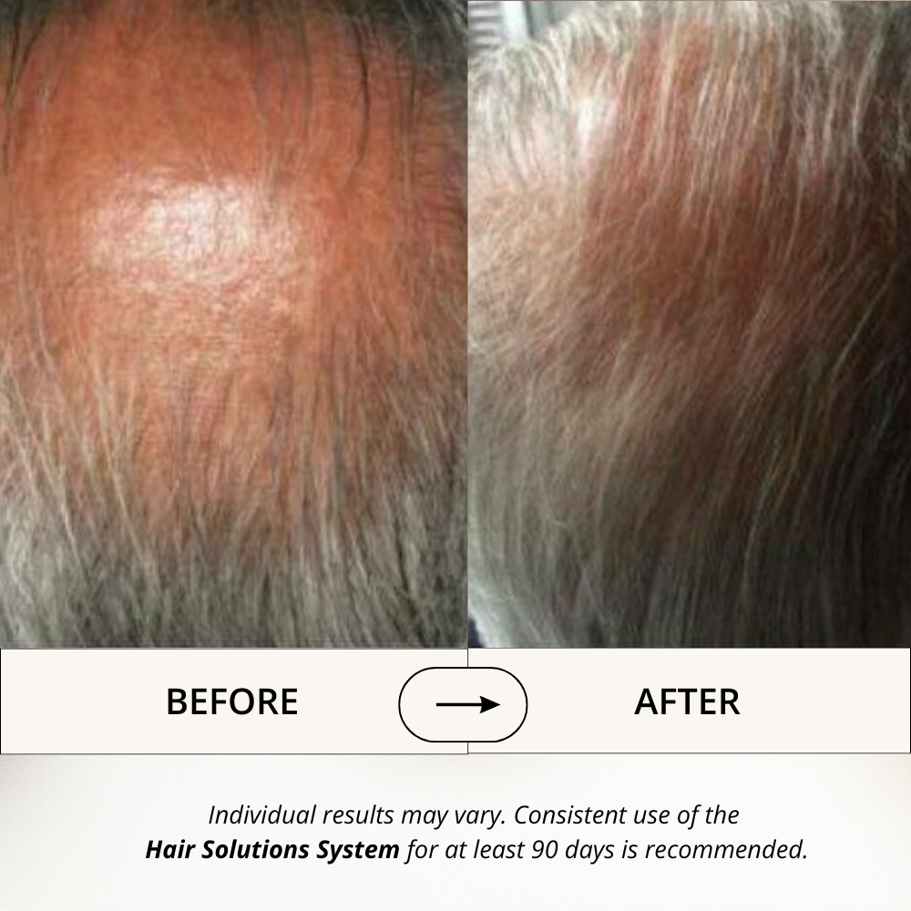 Hair Solutions | Energizing Hair Growth Conditioner