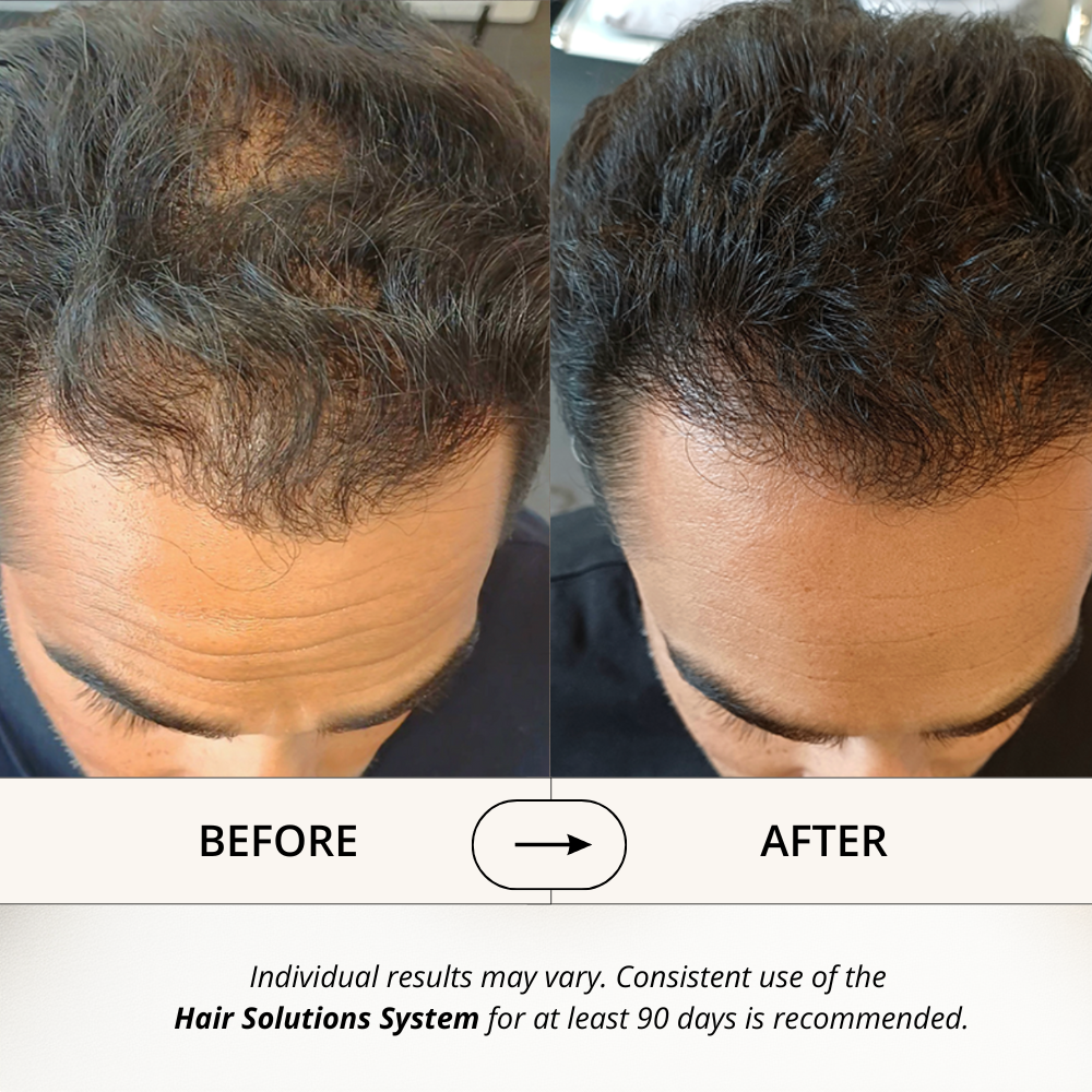 Hair Solutions | Energizing Scalp Serum for Hair Growth