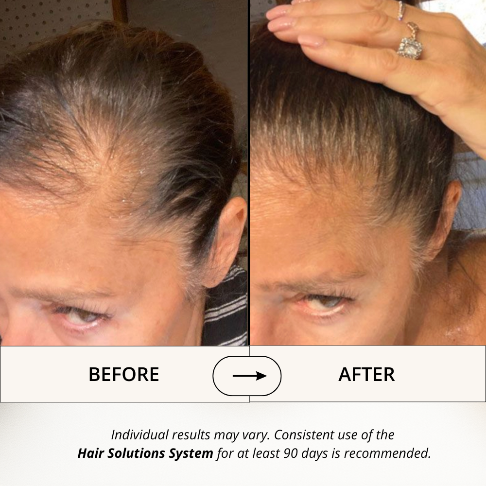 Hair Solutions | Energizing Scalp Serum for Hair Growth