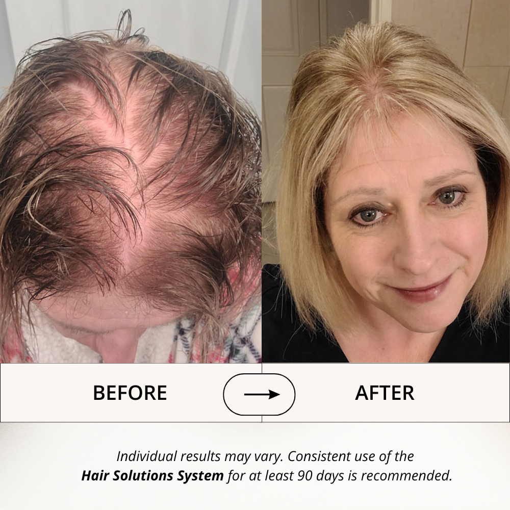 Hair Solutions Energizing Scalp Serum for Hair Growth